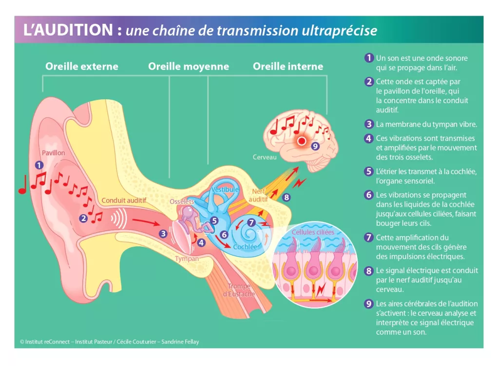 Processuce Auditif Infographie : comprendre le fonctionnement de l’audition | Institut ...